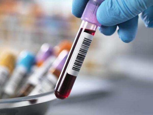 2021繼發(fā)性不孕能做試管嬰兒嗎？