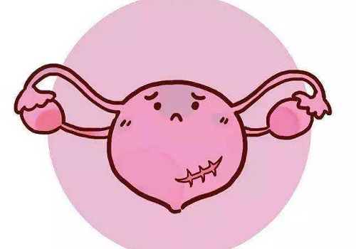 試管洗精術(shù)的費用是多少？促排方案怎么選？